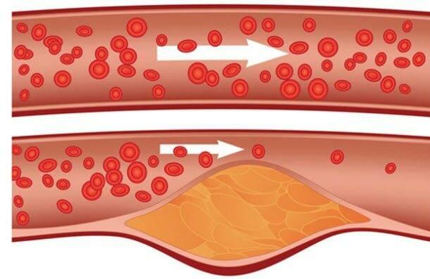Cholesterol có ở màng sinh chất của tế bào