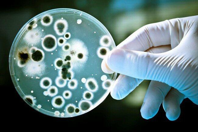 Công nghệ nuôi cấy tế bào vi khuẩn được chuyển gene sản sinh protein của người được thực hiện nhằm mục đích chính là
