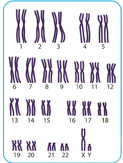 Đúng sai Sinh 12 Nhiễm sắc thể (ảnh 2)