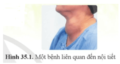 Soạn KHTN 8 Cánh diều Bài 35: Hệ nội tiết ở người