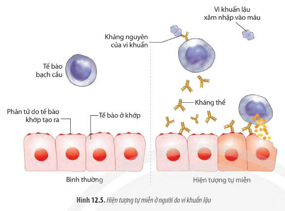 Lý thuyết Sinh học 11 Chân trời sáng tạo Bài 12: Miễn dịch ở động vật và người