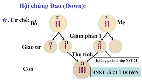 Trình bày cơ chế phát sinh hội chứng Đao, Sơ đồ cơ chế bệnh Đao