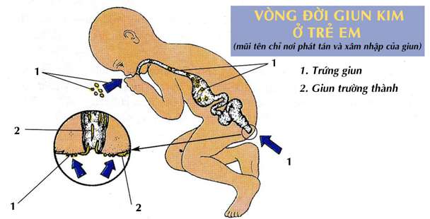 Trình bày vòng đời của giun kim bằng sơ đồ (ảnh 3)