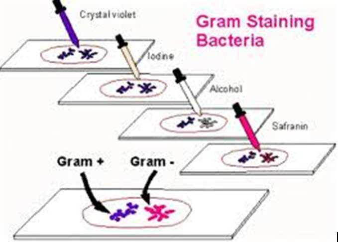 Vẽ sơ đồ quá trình nhuộm gram ( ảnh 4)